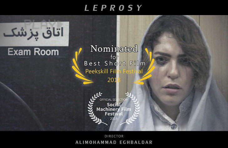 فیلم کوتاه «جذام» کاندید بهترین فیلم کوتاه جشنواره Peekskill آمریکا