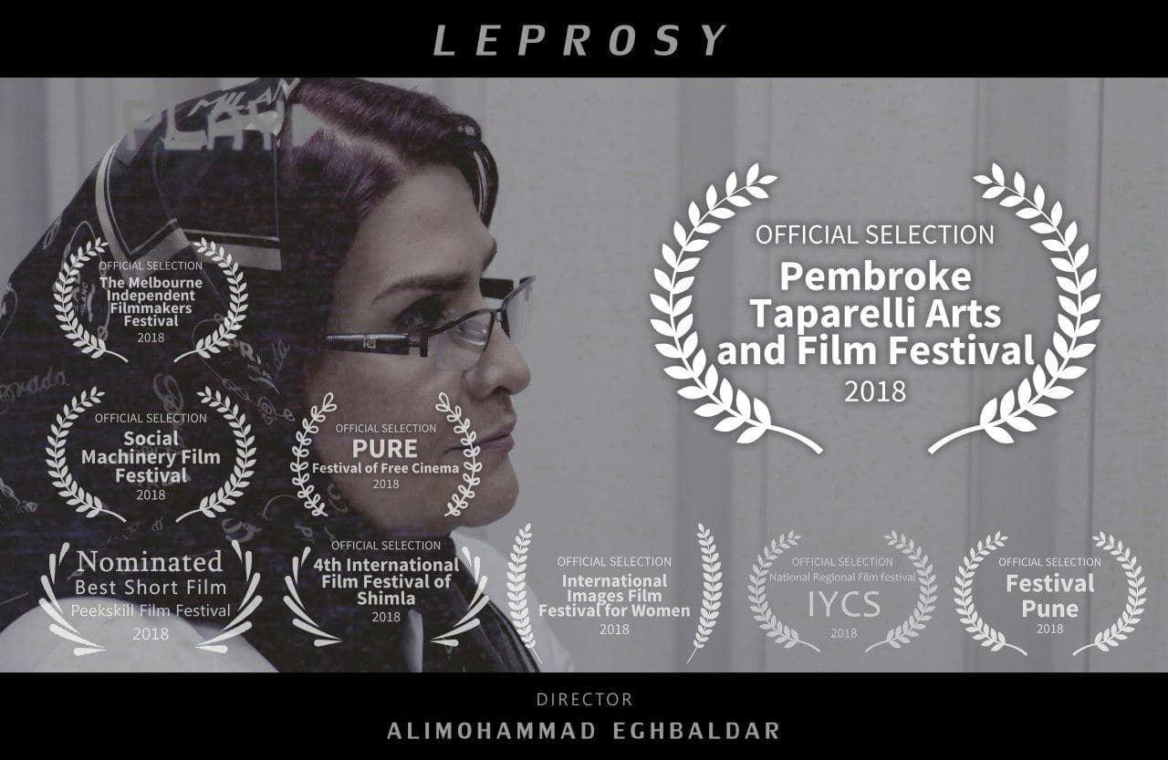 هشتمین حضور بین المللی فیلم کوتاه «جذام» به کارگردانی علیمحمد اقبالدار در آمریکا